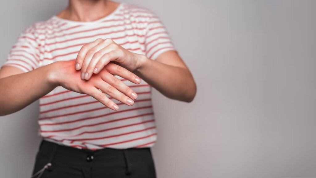Septički Artritis simptomi