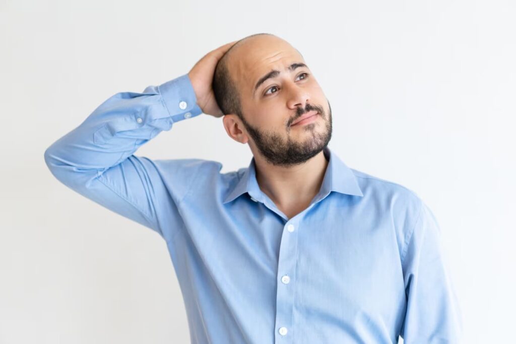 Uzroci Androgene Alopecije