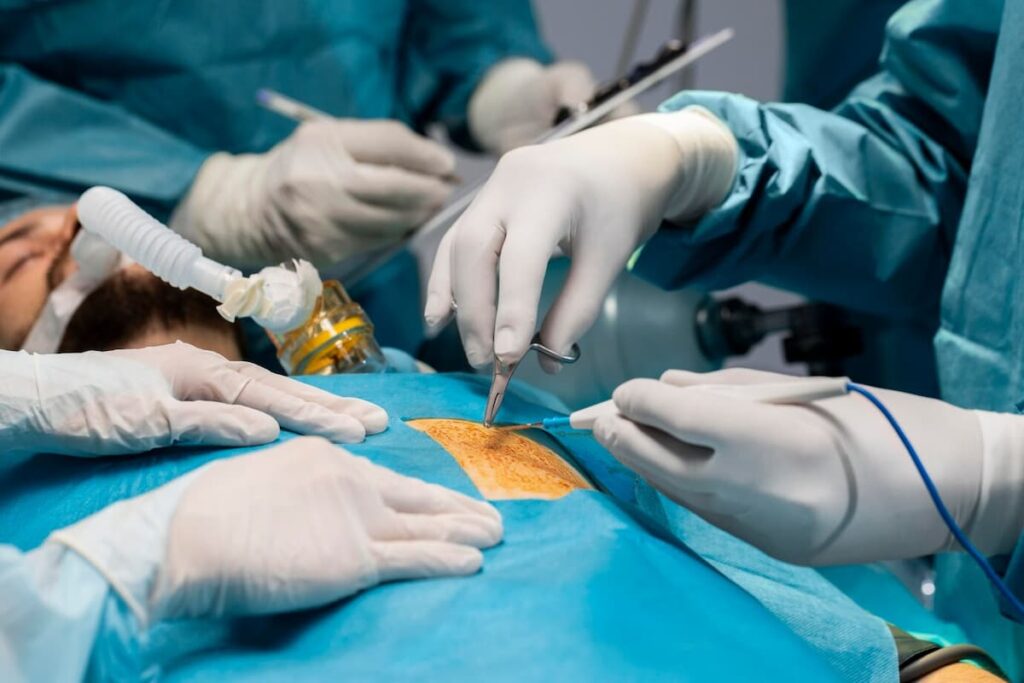 Transplantacija jetre proces