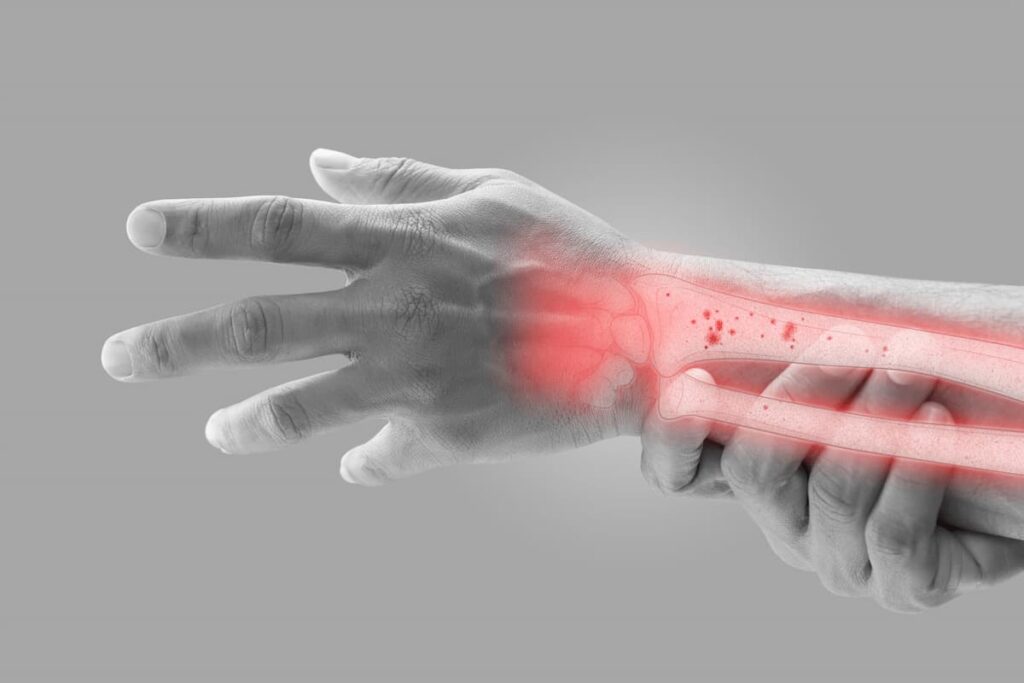Liječenje osteoporoze
